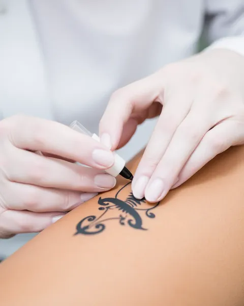 Crema para anestesia para la eliminación de tatuajes dolorosa